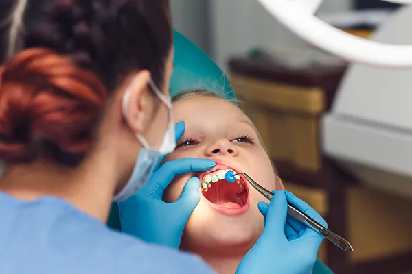 Young boy patiently keeping his mouth open while his female dental assistant applies fluoride at Grins & Giggles Family Dentistry in Spokane Valley, WA